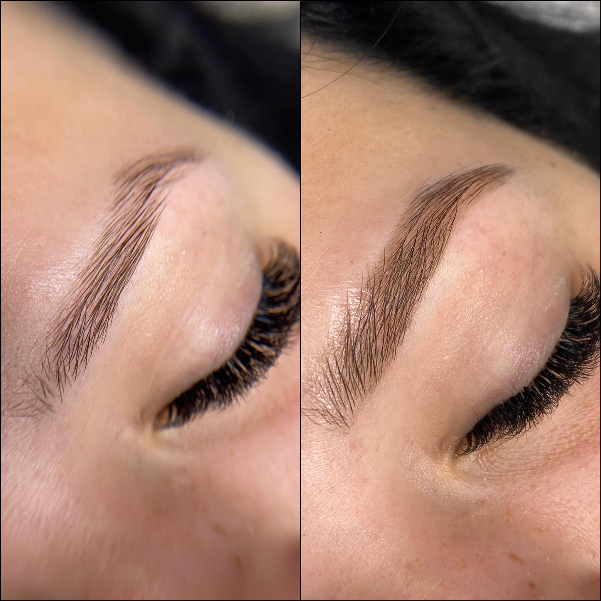 zdjecie nr 3 przed i po