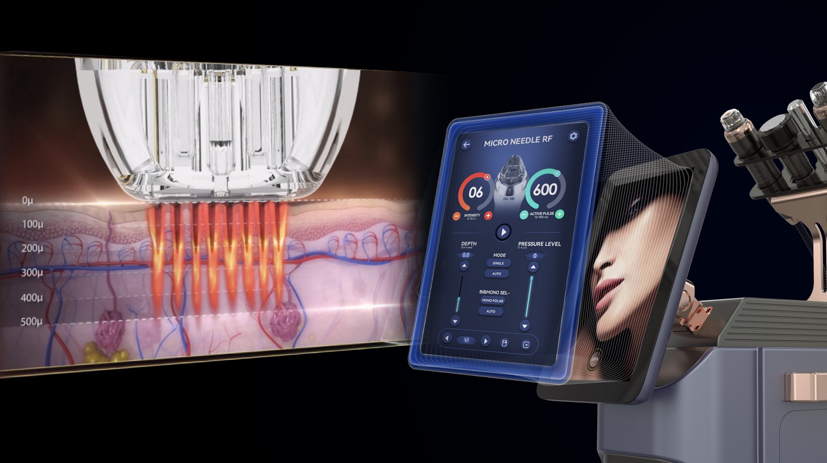 Jak działa radiofrekwencja frakcyjna RF