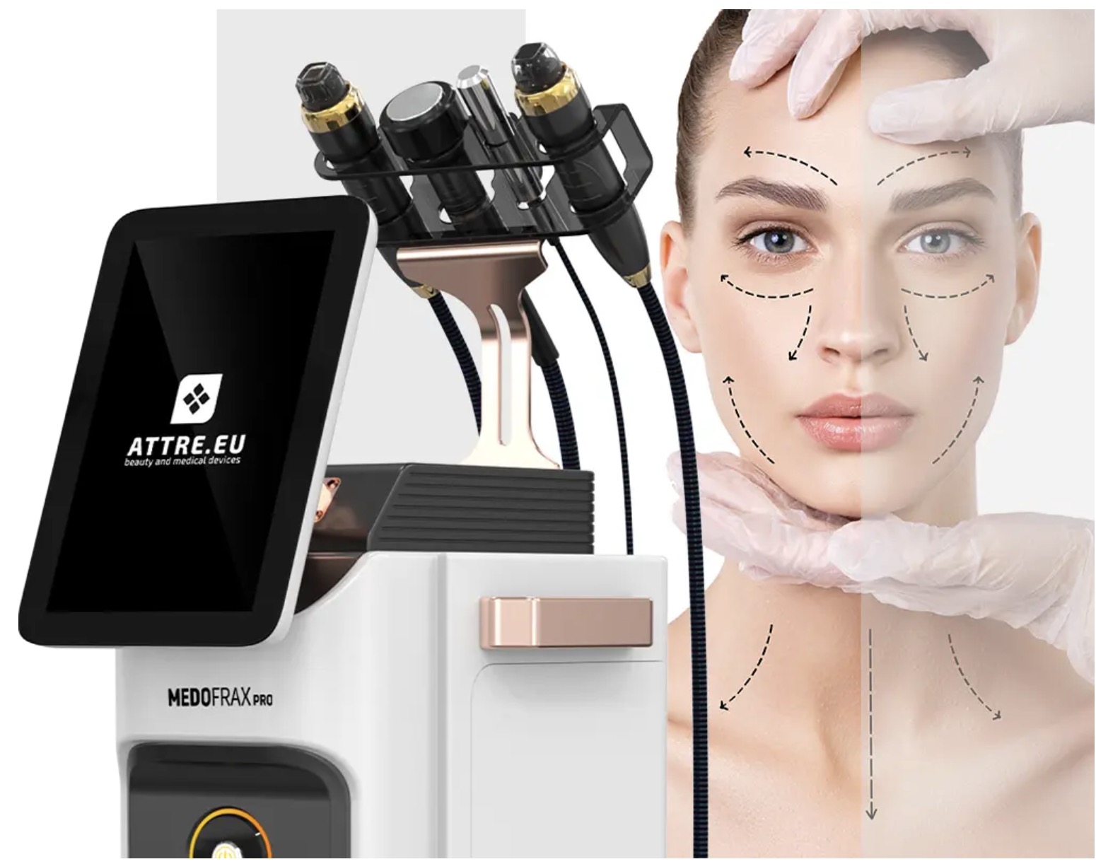 Jak działa radiofrekwencja mikroigłowa RF