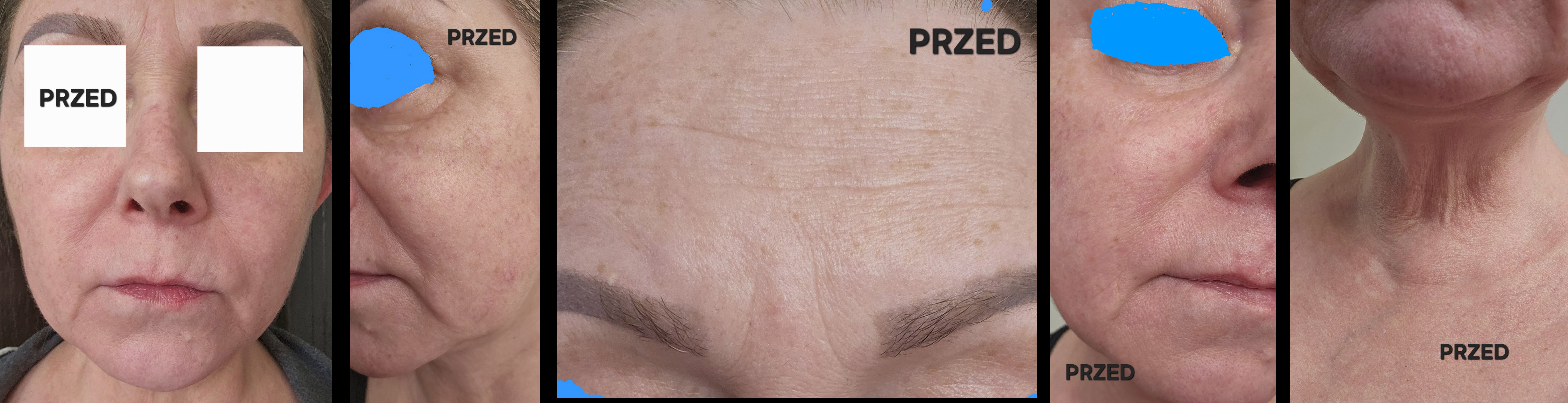 Zdjęcie 1clare copy