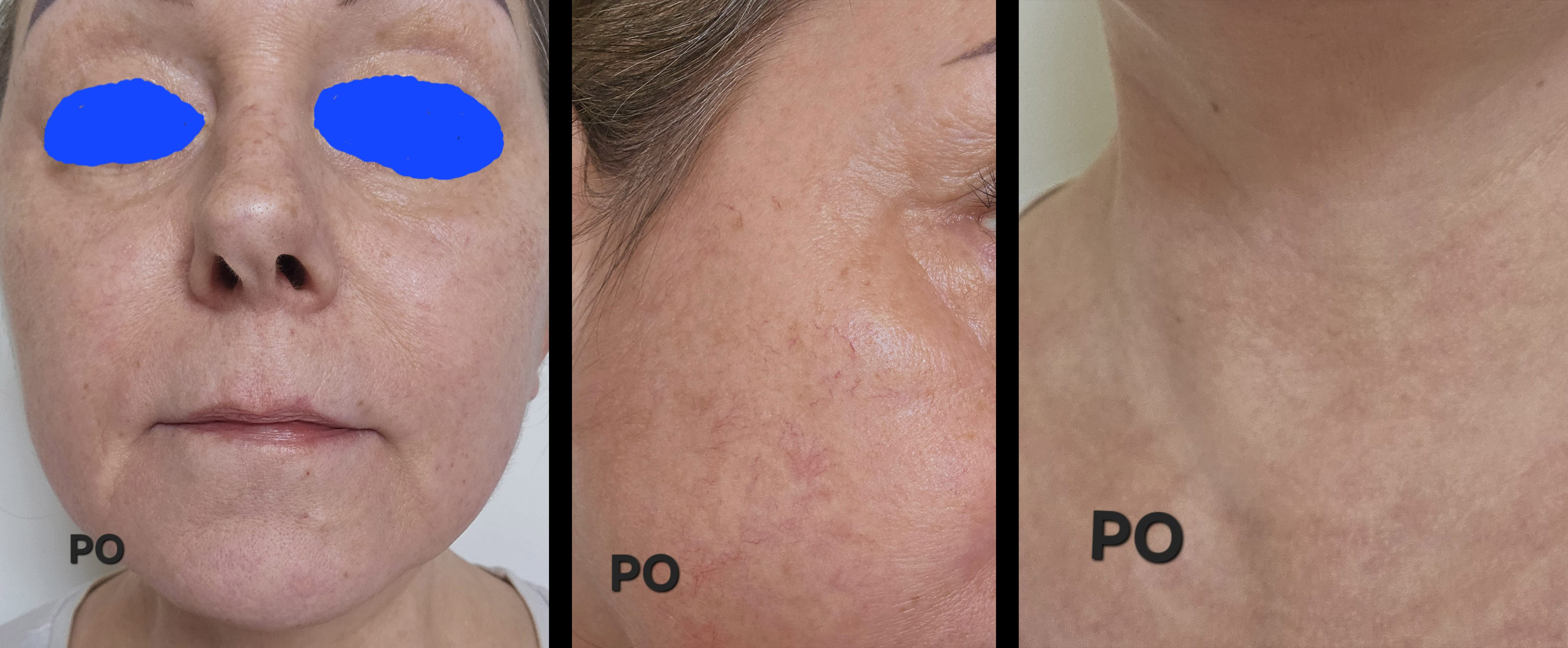 Zdjęcie 6 clare copy