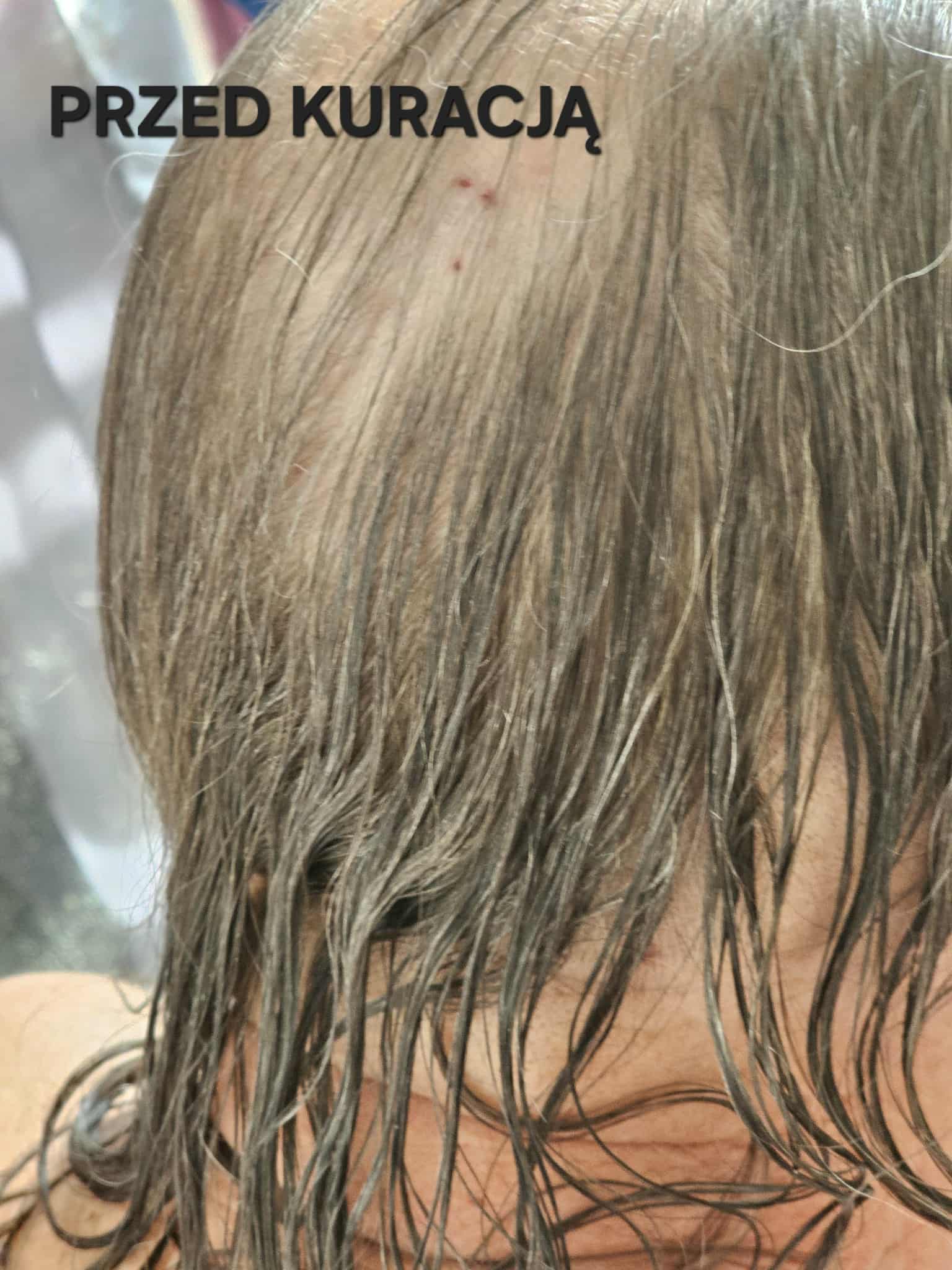 zdjęcie Test Venita przed marek