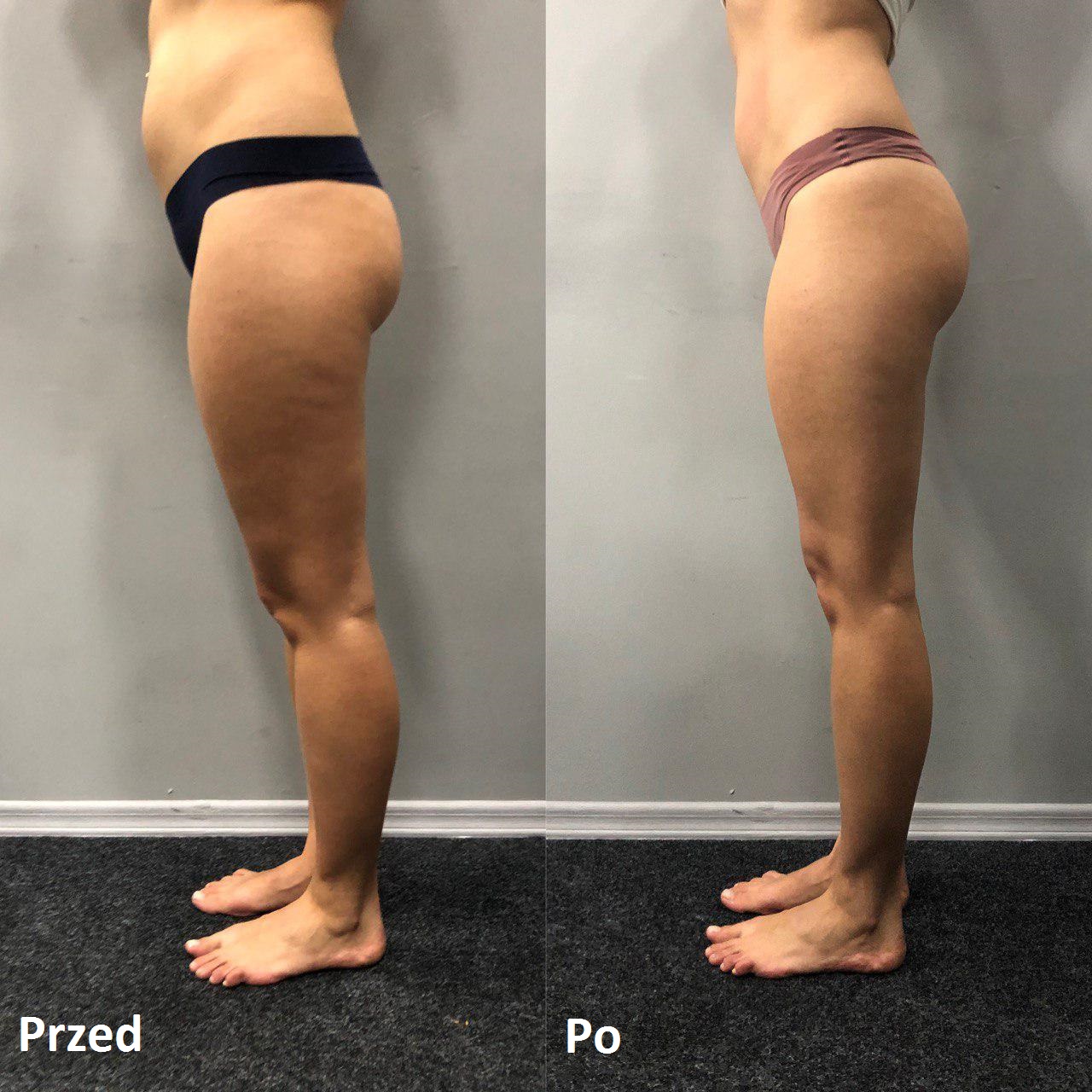 c6ti4f101b6b2fefd453abd3f7491f25564de