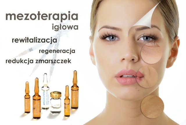 mezoterapia_iglowa