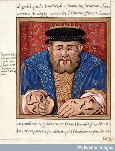 historia_pijawek_lekarskich_3