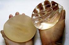 implanty-61597717a9f7ed58df96359c6ae4c07703d7b5e2