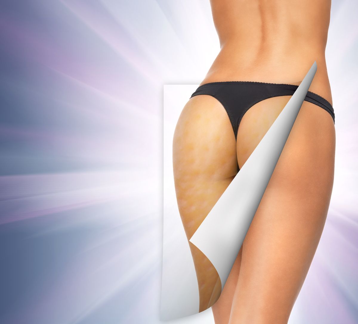 Lato_bez_cellulitu_-_Fotolia.com