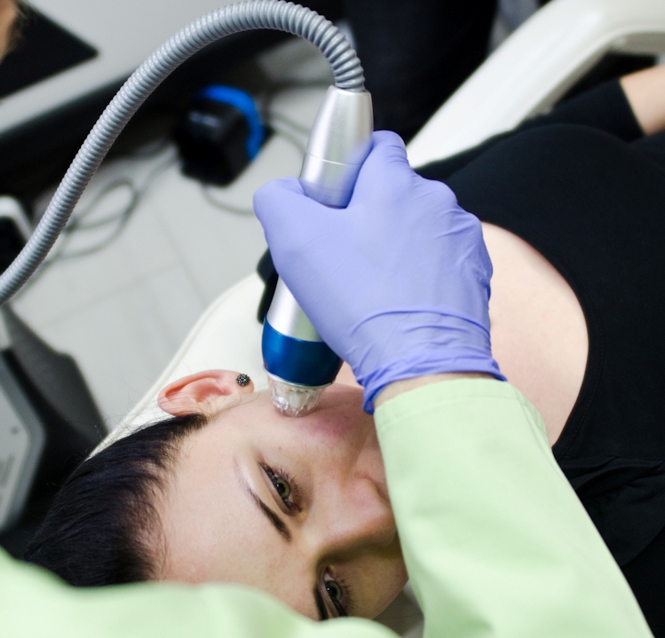 usuwanie blizn zanikowych, kosmetyka twarzy, blizny, blizny zanikowe