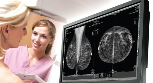 rak piersi