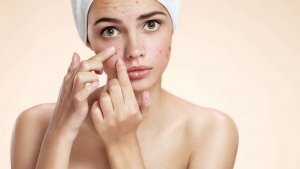 Jak pielęgnować skórę trądzikową