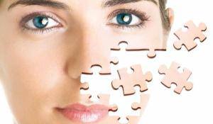 Frakcyjna radiofrekwencja mikroigłowa